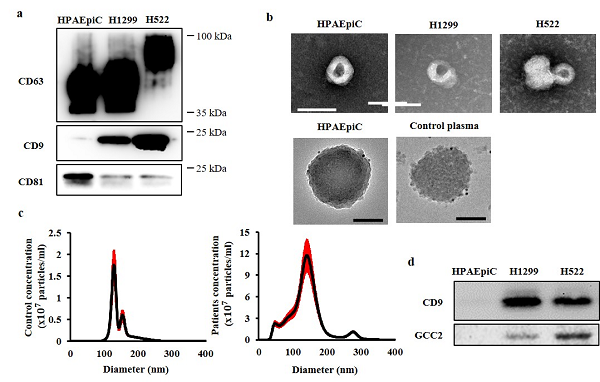 The team examined the expression level of the selected biomarker GCC2 in the exosomes through characterization of exosomes obtained from cell lines (western blotting, electron microscopy, NTA) and proteomic analysis. As a result, biomarker GCC2 was not detected in the standard cell line, HPAEpiC, but only in the lung cancer cell line.
