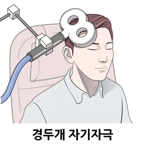 Transcranial Magnetic Stimulation (TMS) is a non-invasive brain stimulation technique that uses a magnetic field produced by a coil-shaped like the number 8 to stimulate or inhibit specific brain areas by passing through the skull (Image: Gangnam Severance Hospital).