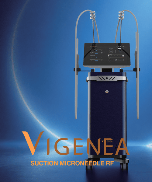 Newpong VIGENEA radiofrequency medical device