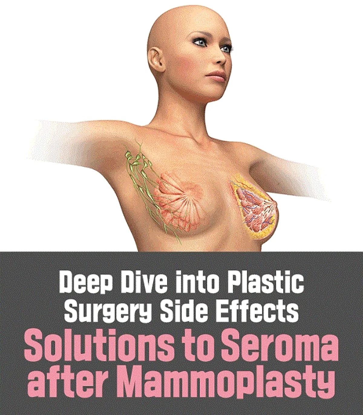 Understanding Seroma: A Complication After Mammoplasty