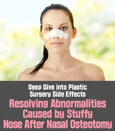 Navigating Rhinoplasty Complications