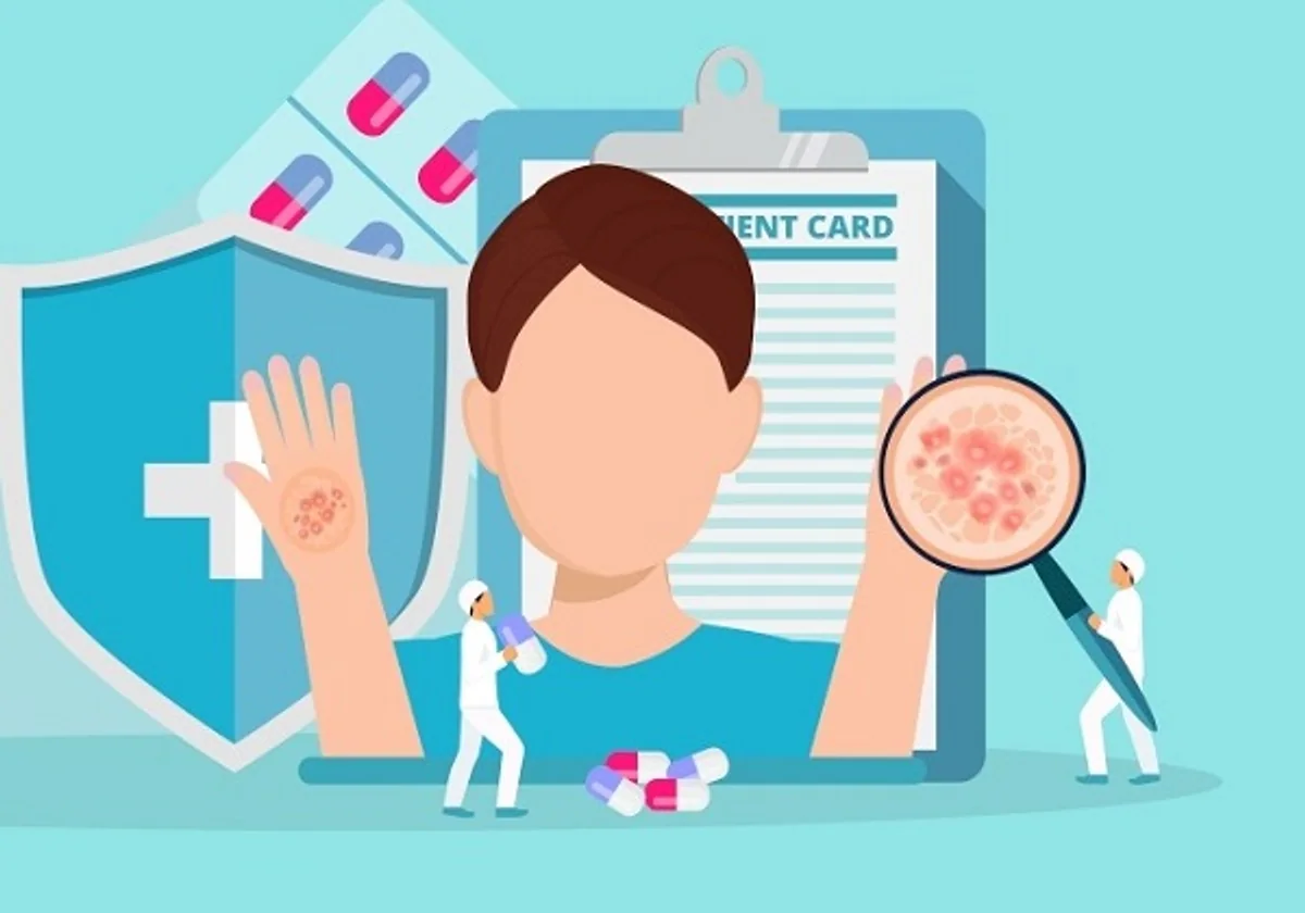 Understanding Radiation Dermatitis in Patients Undergoing Therapy