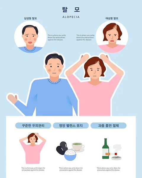 Understanding and Managing Androgenic Alopecia