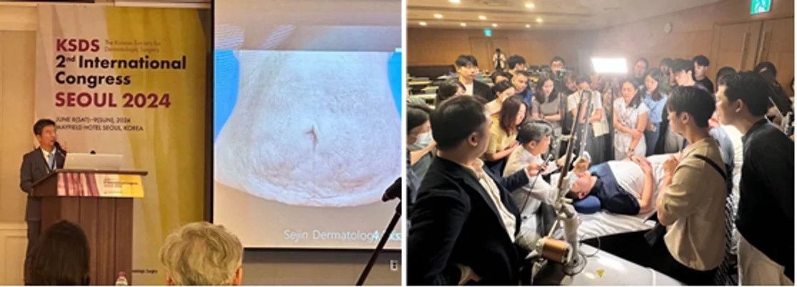 Advancements in Needle-Free Drug Delivery: Mirajet's Impact at the 2024 KSDS International Conference