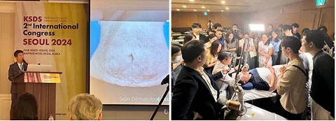 Advancements in Needle-Free Drug Delivery: Mirajet's Impact at the 2024 KSDS International Conference