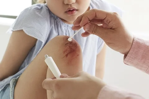 Effective Use of Antiseptics and Ointments for Wound Care