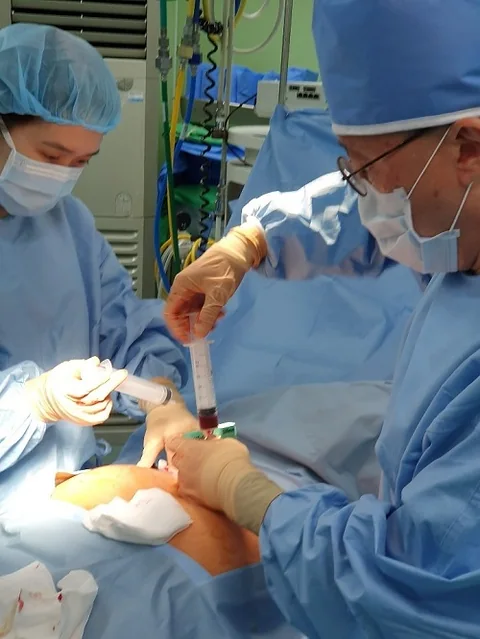 Advancements in Hematopoietic Stem Cell Transplantation: A Revolutionary Treatment for Blood Cancers