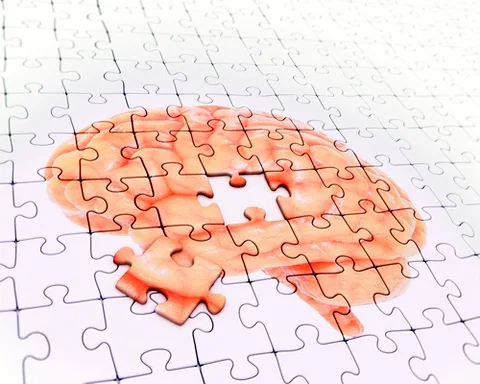 Innovative Approaches to Combating Dementia